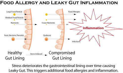 food-allergy-leaky-gut-inflammation